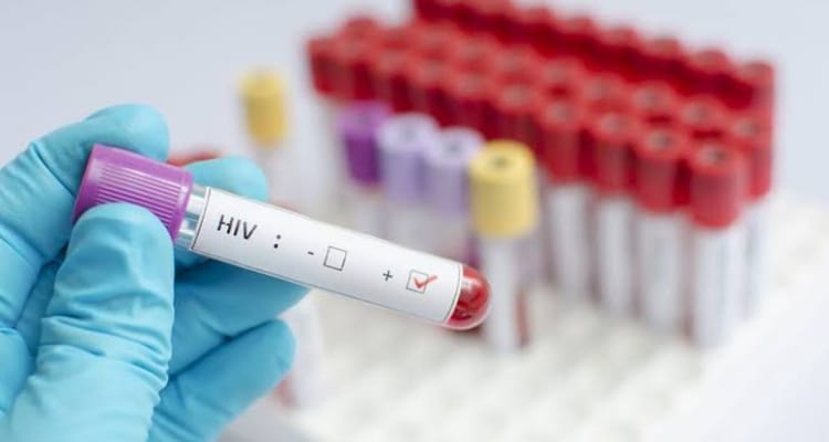 VIH, nueva variante vacuna