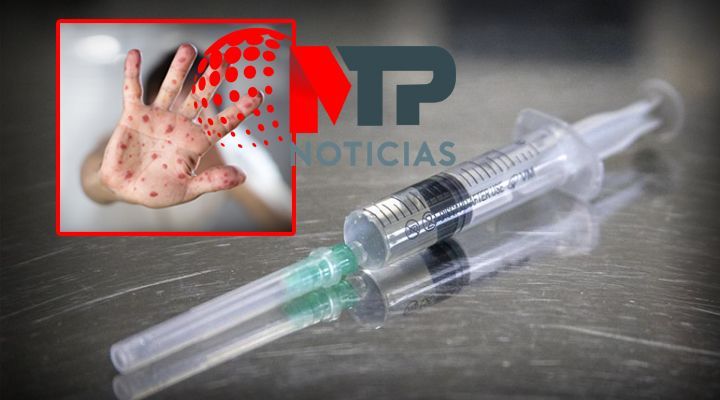Viruela del mono vacunas en Mexico