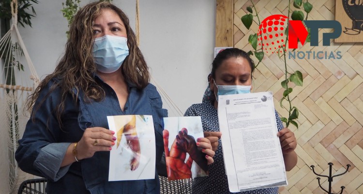 Otra vez clausuran clínica en Cacalotepec, donde amputaron brazo a bebé Matías