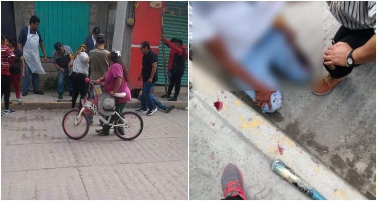 Dos hombres heridos en Santa Ana Xalmimilulco