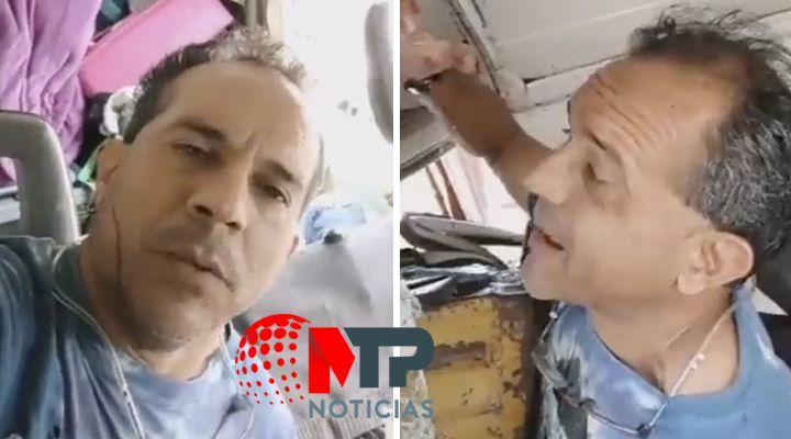 hombre transmite en vivo tras ser embestido por trailer en Puebla 1