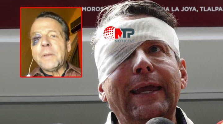 Alfredo Adame quedara ciego de un ojo tras golpiza