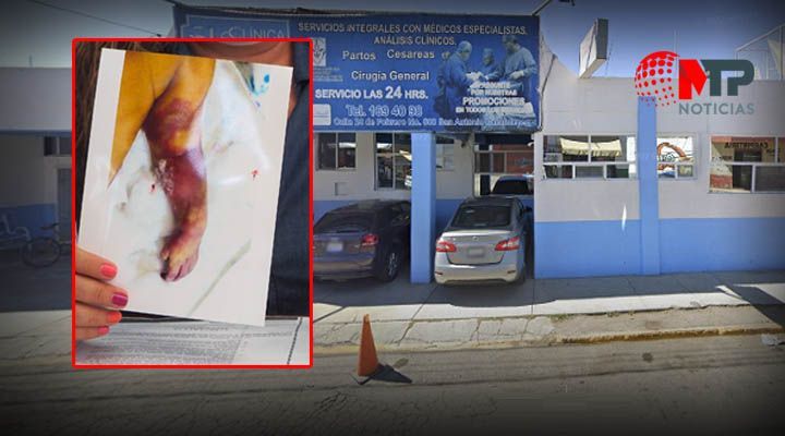 Vuelven a clausurar Clinica San Antonio en Cholula donde amputaron brazo a bebe Matias