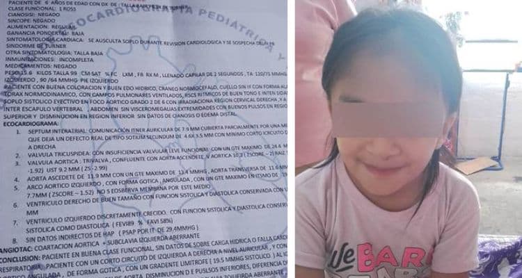 Puebla Ayuda: la niña Jade necesita 140 mil pesos para tratar el síndrome de Turner