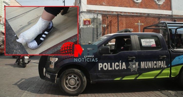 Ambulante lesionada durante operativo en Puebla provocó su herida, aseguran