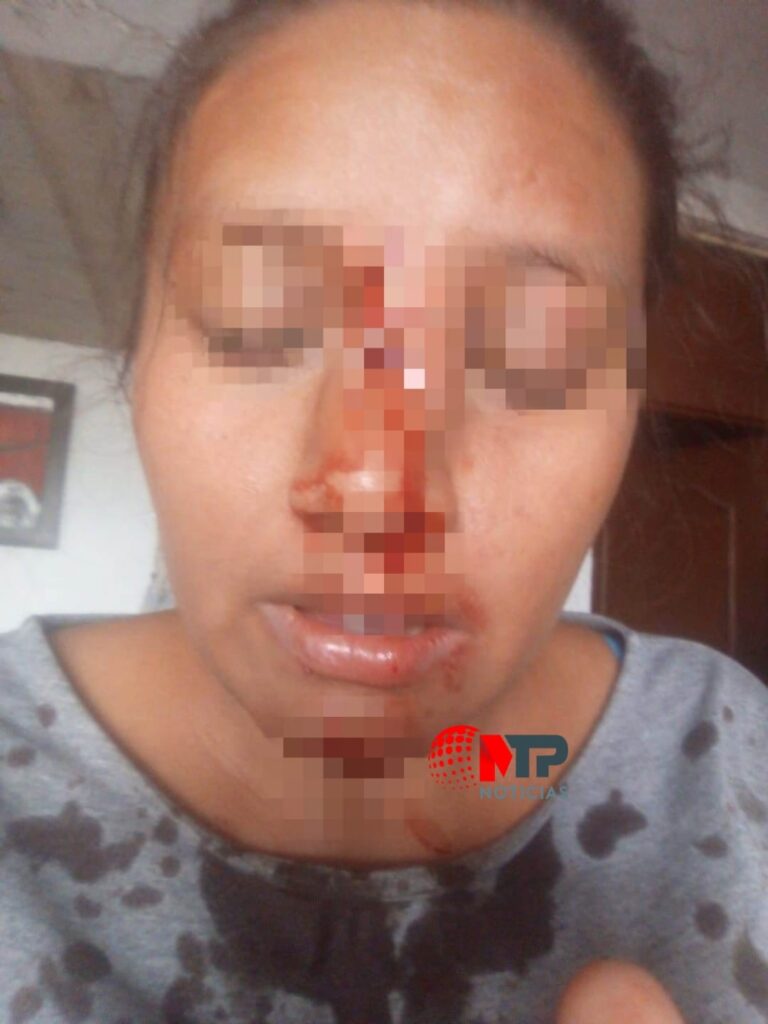 Gehidi de 26 años golpeada por el primo de su esposo