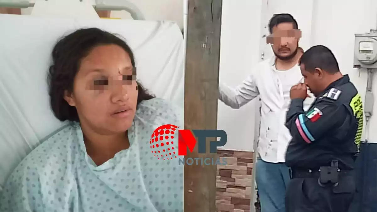 Intento de feminicidio en Puebla a Gehidi le fractura la nariz a golpes el primo de su esposo