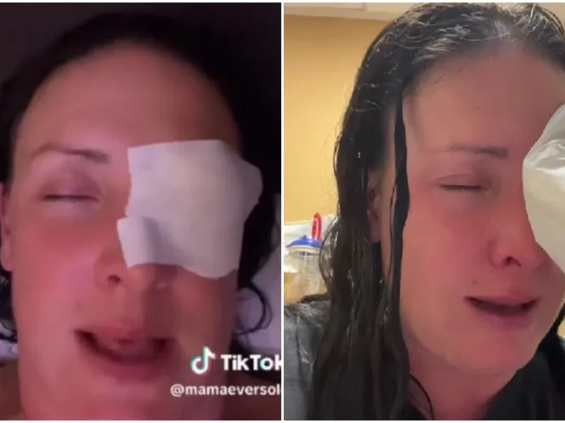 Mujer confunde gotas para ojos con pegamento y termina en el hospital