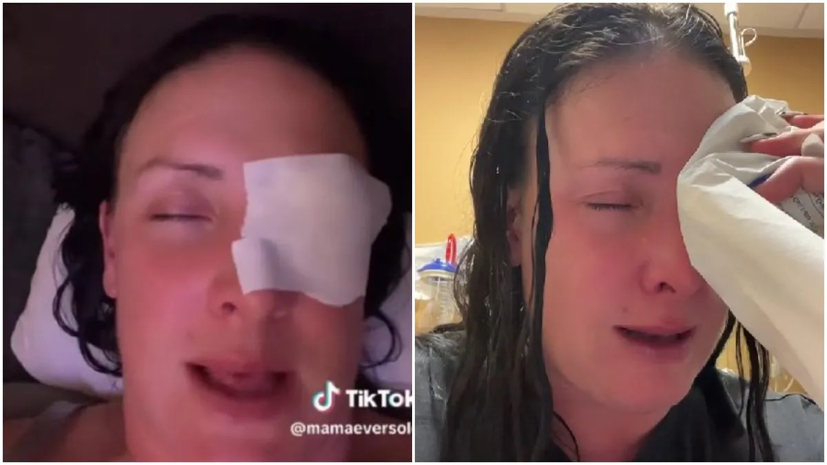 Mujer confunde gotas para ojos con pegamento y termina en el hospital