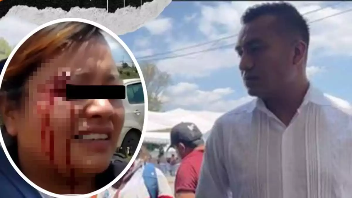 Brigadistas de diputado Roberto Solís golpean a policía de Huejotzingo