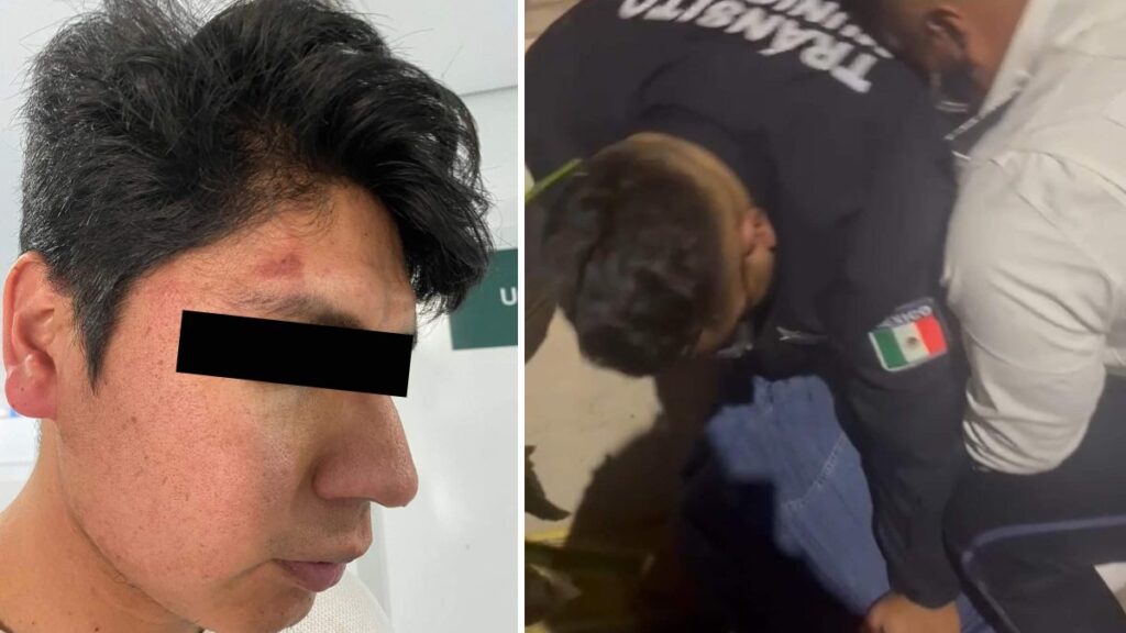 Rostro de estudiante BUAP  golpeado por policías de San Andrés Cholula en Puebla.