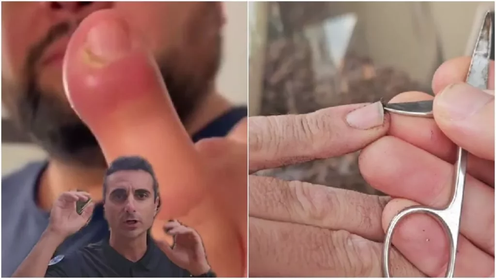 Paramédico revela lo peligroso que es comerse las uñas, ¿lo haces?