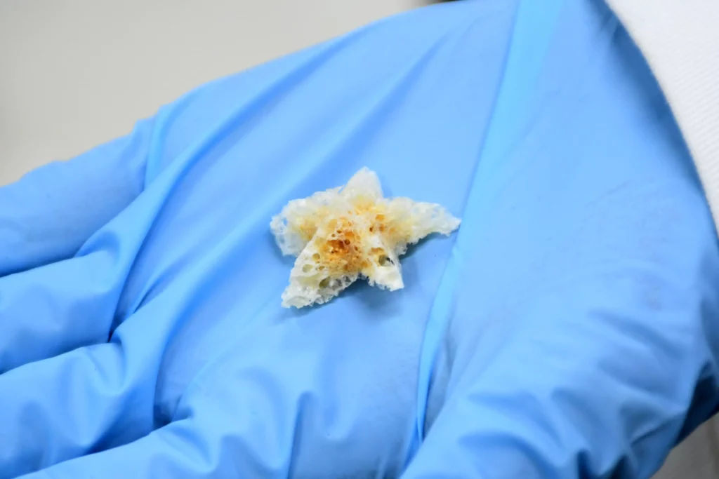 En BUAP crean esponjas biodegradables y nanofibras poliméricas para regeneración ósea