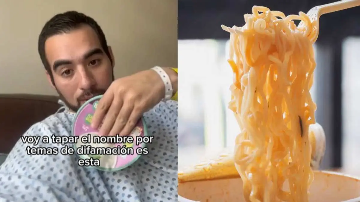 Hombre pierde un trozo de intestino tras comer sopa instantánea