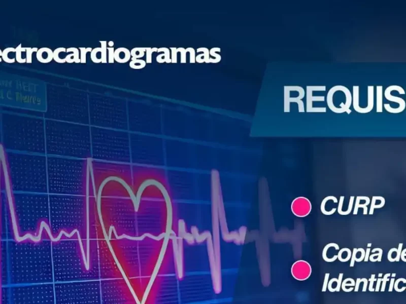 Electrocardiograma gratis en el SMDIF por 'Día Mundial del Corazón'